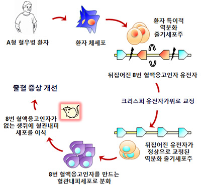 혈우병 환자의 iPS 세포에서 유전자 교정 후 혈관내피세포로 분화시킨 다음 동물 모델에 이식 시 혈액 응고 효과를 보여 출혈 증상을 개선함