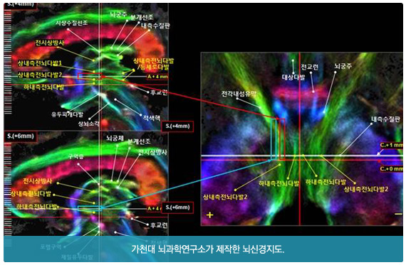 가천대 뇌과학연구소가 제작한 뇌신경지도