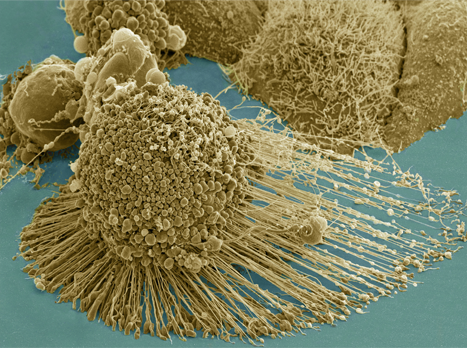 HeLa 세포의 주사전자현미경 사진. HeLa 세포는 채취된 이래 수많은 연구실에서 끊임없이 증식을 거듭하고 있다. 배양 중 일어난 돌연변이로 HeLa 세포의 염색체 수가 사람과 달라져 아예 HeLa 세포를 인간이 아닌 새로운 생명체의 세포로 간주해야 한다는 의견도 존재한다. ⓒ National Institutes of Health