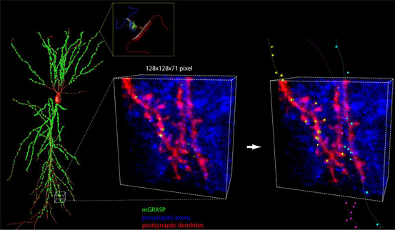 mGRASP로 찾아낸 흰쥐 뇌의 시냅스 구조. 현미경으로 시냅스의 위치와 연결상태를 직접 확인할 수 있다. ⓒ김진현/KIST