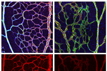 Loss of Pericytes Deteriorates Retinal Environment