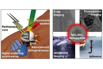 New Harmless Radiopaque Glue to Seal Bleeding and Guide Surgery