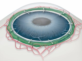 Draining Eyes Clogged with Glaucoma