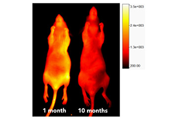 Unprecedented Contrast Agent to Measure the Age of Skin and Blood Vessels