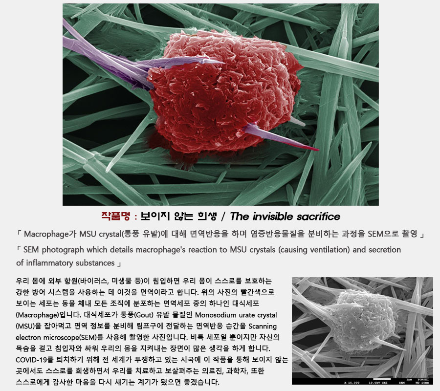 보이지 않는 희생