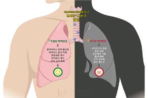 [코로나19 과학 리포트]_Vol.9 코로나바이러스, 결국은 면역이다 <하>