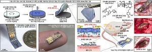 극한의 얇기로 인체에 완벽 밀착하는 초박막 소자 나왔다