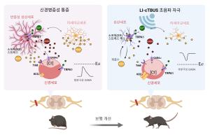 뇌파 모사한 초음파로 만성 통증 치료한다