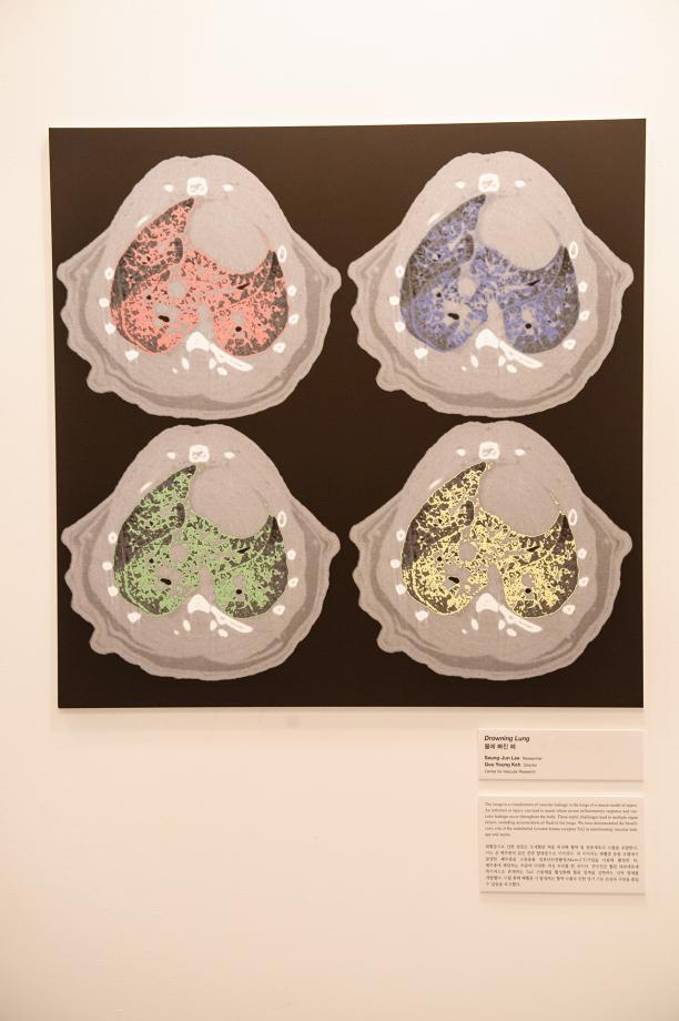 2nd Prize, Center for Vascular Research_Drowning Lung