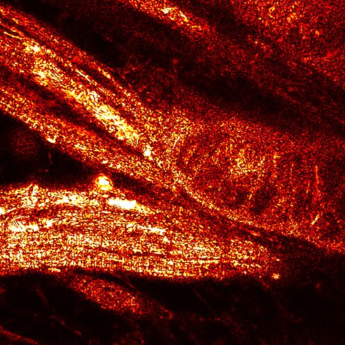 몸짱 제브라피시