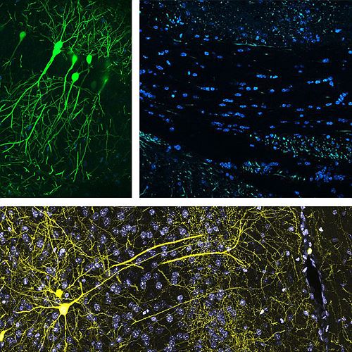 부분과 전체 삼부작: 접, 모래톱, 밤하늘로의 이륙