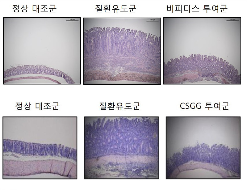 연구진은 이번 연구로 이로운 프로바이오틱스인 비피더스 PRI1균을 장 질환 염증을 가진 실험쥐에 투여하자 3주 후 염증이 줄어듦을 확인했다(위). 흥미롭게도 비피더스 PRI1균에서 순수 분리한 세포 표면 다당체(CSGG)만 실험쥐에 투여해도 염증성 장 질환의 억제 효능을 확인했다(아래)