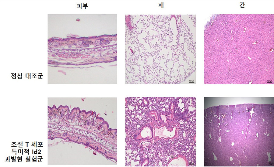 16 주령 된 정상 생쥐와 조절 T세포에서 특이적으로 Id2를 과발현시킨 생쥐를 비교했다.  피부, 폐 그리고 간 조직을 염색 기법을 통해 침투된 림프구의 정도를 확인한 결과, 정상 생쥐에 비해 실험군인 Id2가 과발현된 생쥐가 염증의 정도가 높았음을 볼 수 있었다. 또한 실험군에서는 자연발생적으로 자가 면역질환이 발생했을 때와 유사한 질환이 관찰되었다.