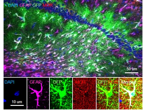 Figure 1 A representative image of MOR over-expression in hippocampal astrocytes of MOR-KO mice.