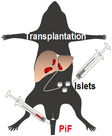 PiF를 이용하면 췌장섬 이식 수술의 성공여부까지 추적 관찰할 수 있다.