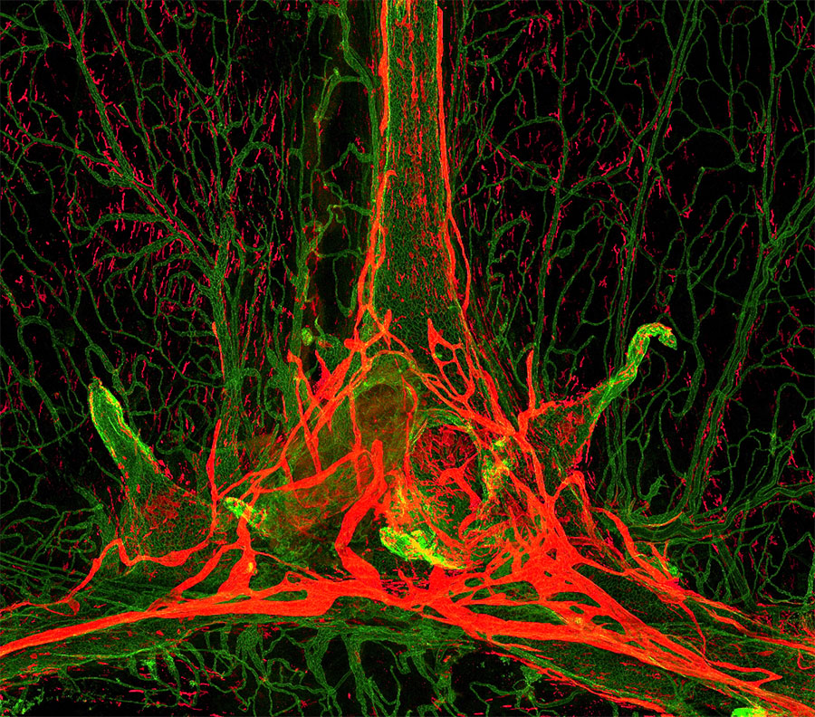 brain on fire cahalan brain on fire cahalan