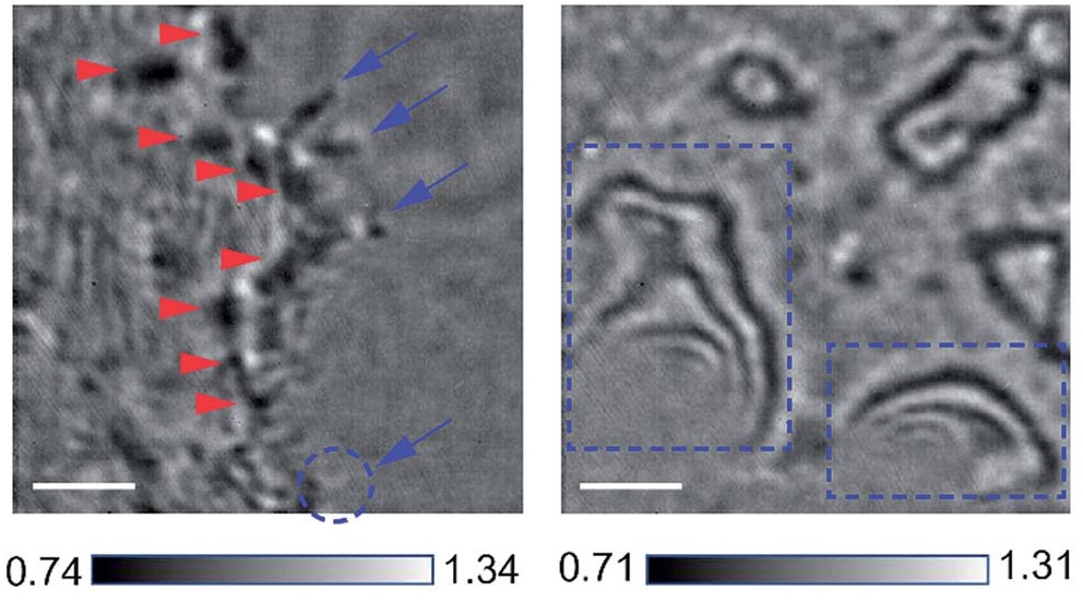 연구진은 간섭산란현미경(오른쪽)을 이용하면 광학현미경(왼쪽)에 비해 세포 내외부 구조를 선명하게 관찰할 수 있음을 규명했다.(출처: Chemical Science)