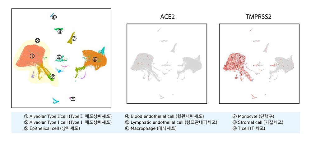 양명진 연구원은 공개된 GSE122960 유전정보에 근거해 성인 8명에게서 채취한 4만1082개 폐세포의 단일 세포 유전자발현을 분석했다. 2019-nCoV가 인지하는 효소 중 하나인 ACE2(가운데 그림)는 TypeⅡ 폐포 세포에서만 특이적으로 발현되는 반면, 바이러스 단백질을 가공하여 세포 내 침입을 가속화하는 효소인 TMPRSS2(오른쪽 그림)는 폐 상피세포 전반에 걸쳐 높게 발현되는 양상을 보인다.