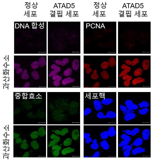 [그림1] 활성산소에 의한 복구 DNA 합성은 ATAD5 단백질 결핍 시 늘어난다. 이미지로서 자세한 내용은 하단에 위치해 있습니다.