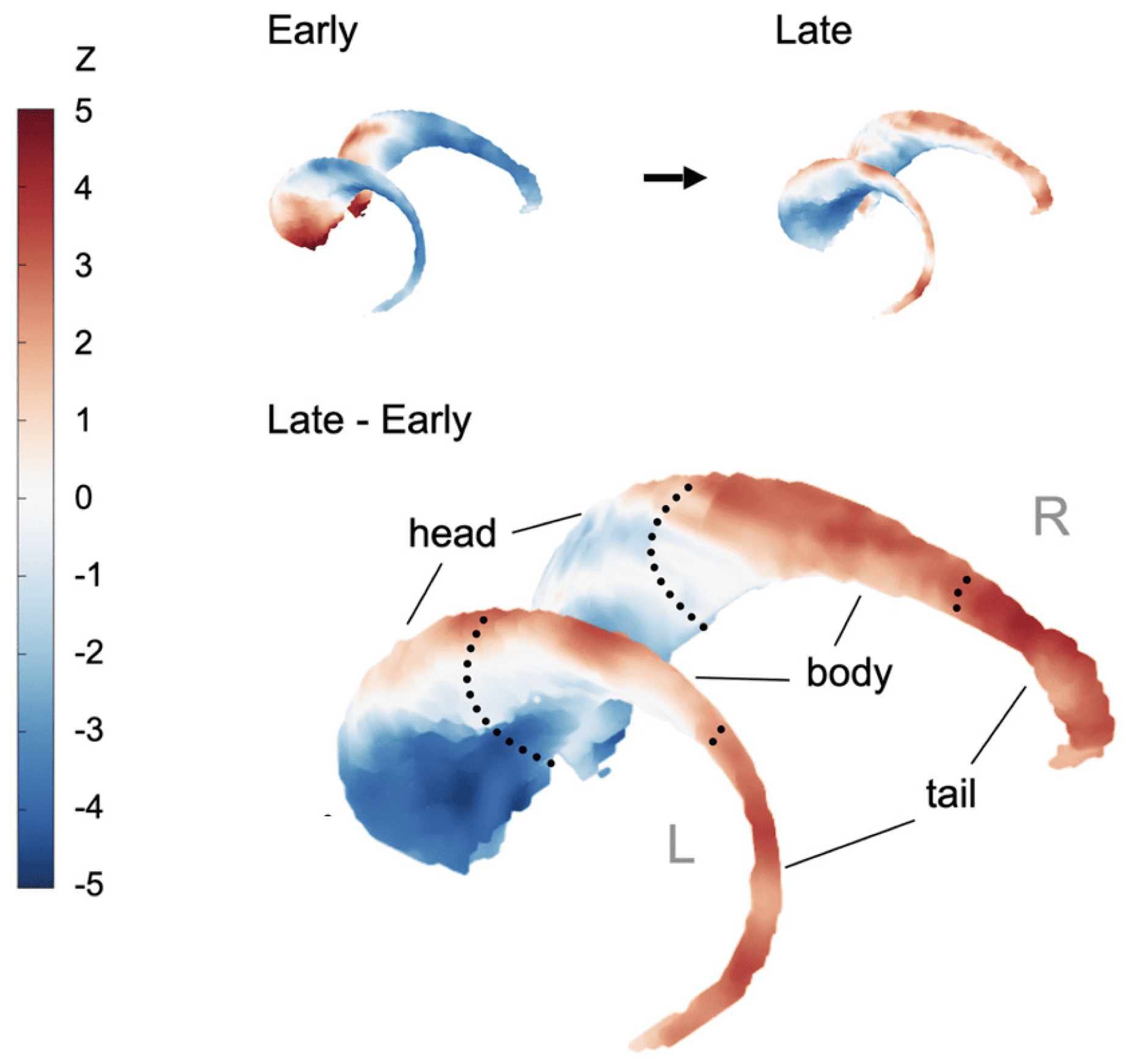 Professor KIM Sung Shin’s team analyzed the activation patterns in the caudate nucleus, a brain region related to reward and motivation, using functional nuclear magnetic resonance imaging. The results were pushed in the Proceedings of the National Academy of Sciences (PNAS) in 2020.In the initial stage (Early) of first learning a new motor task, the head of the caudate nucleus is activated. When the motor task is performed proficiently (Late), a transition occurs where the tail part of the caudate nucleus is activated. In the figure on the right showing the difference (Late-Early) between before and after learning, it can be seen that the activation of the head decreases (blue region) while the activation of the tail increases (red region) as learning progresses.