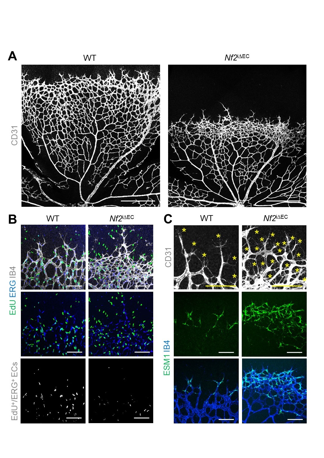 [그림 1] 혈관 특이적으로 Merlin의 발현을 억제했을 때 생후 6일째 생쥐 망막혈관의 변화
            혈관내피세포 특이적으로 Merlin의 발현을 억제했을 때 망막혈관의 앞부분 첨단세포들과 사상위족이 대조군에 비해 증가하였지만 세포증식은 줄어드는 것을 확인했다(그림 A-B). 첨단세포 마커인 endothelial cell specific molecule-1(ESM-1)이 대조군에 비해 증가한 것을 관찰했다(그림 C).