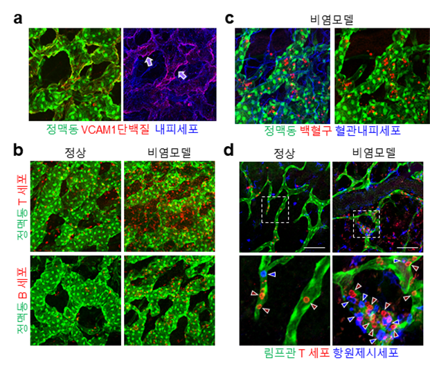 ▲ 비강 내 정맥동과 비전형적 림프관의 면역반응에 대한 특수화
            정맥동 혈관에서 VCAM1이라는 면역세포의 이동에 중요한 단백질이 특이적으로 발현하고 있는 것을 시각화하였고(그림 a), 생쥐 비염모델에서 정맥동 및 비강 내에 면역세포들이 증가함(그림 b). 비염모델에서 면역세포들이 주로 정맥동 혈관에 특이적으로 결합하여 비강내로 유입됨(그림 c), 비전형적인 림프관 내에는 정상에서보다 많은 수의 다양한 면역세포들이 들어가 이동함(그림 d). 이러한 과정을 통해 정맥동 혈관과 비전형적 림프관이 외부에서 침입하는 병원균에 대하여 면역반응을 잘 할 수 있도록 특수화 되어 있다는 것을 발견함. 