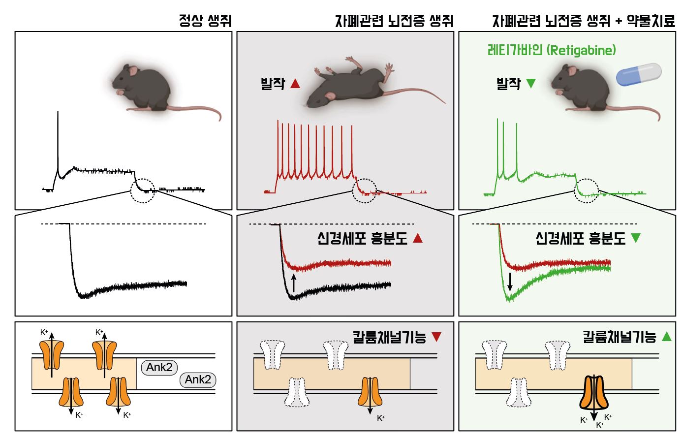 [그림 1] 약물치료를 통한 자폐 관련 뇌전증 증상 완화