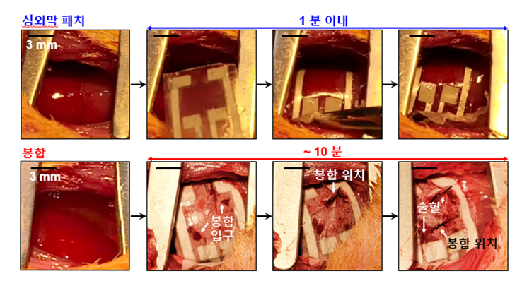 류마티스 관절염 환자의 활막세포 염증에 비례하여 마오비 (MAO-B)와 가바(GABA) 증가
