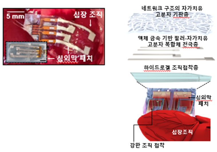 마오비가 류마티스 관절염 동물 모델의 관절 염증의 원인