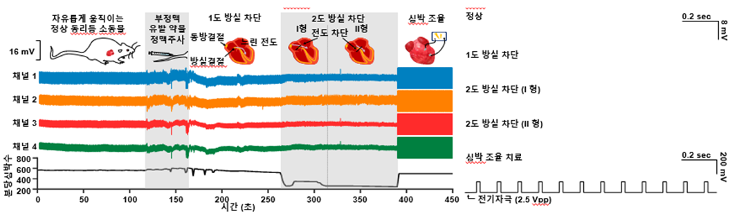 류마티스 관절염에서 마오비의 염증과 인지장애 기전 