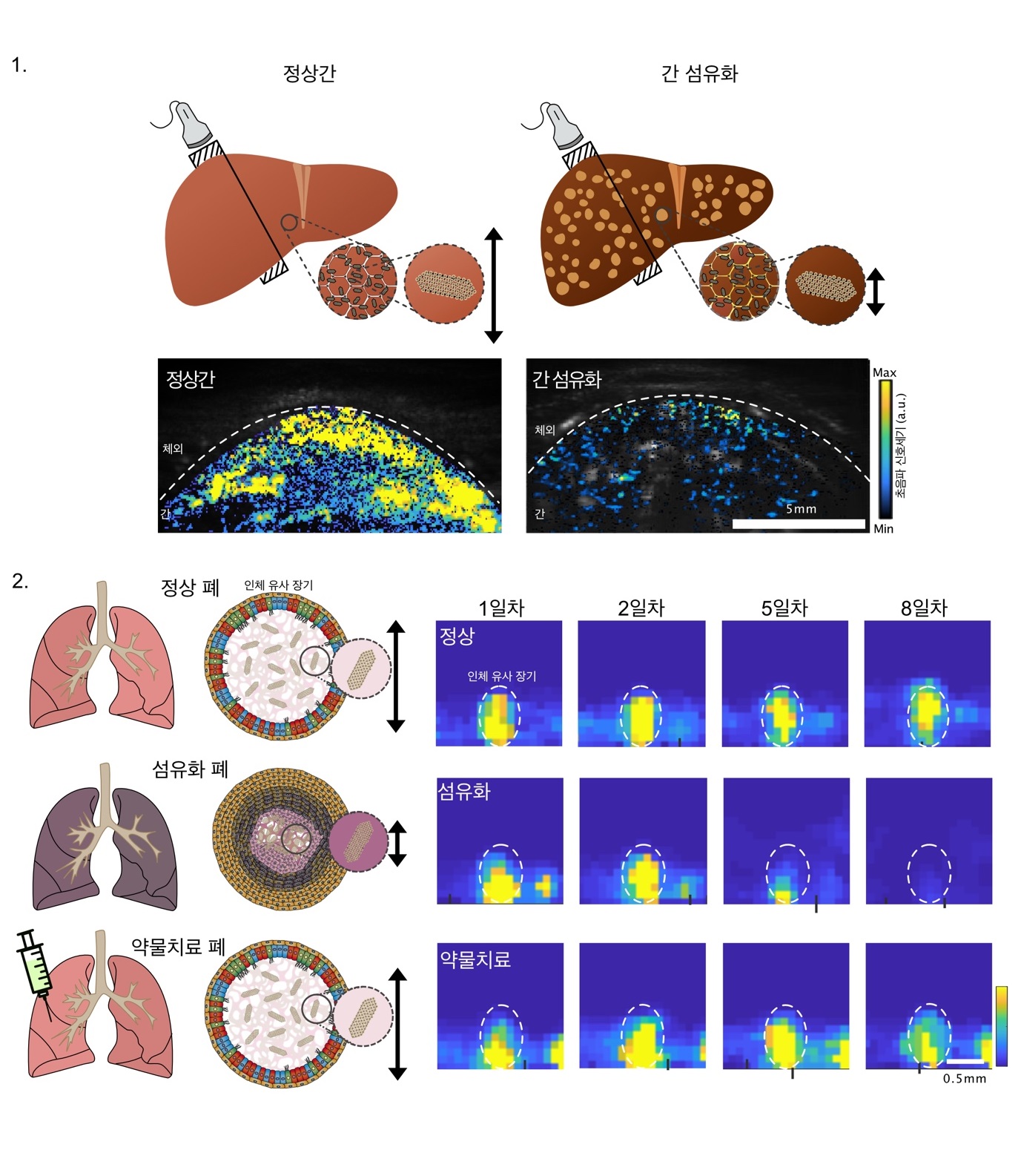 [그림4] 나노 자성-버블을 적용한 비침습적 조직 검사 실험 예
            1. 나노 자성-버블을 쥐에 주입하여 정상 간과 간 섬유화 모델에서의 초음파 이미지
            2. 정상, 섬유화, 약물치료 폐 오가노이드에서 나노 자성-버블의 질병 진단 및 약물 치료제의 효과를 추적 관찰함