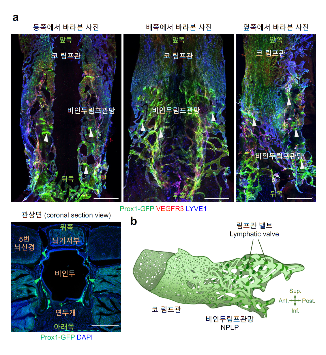 [그림 1] 비인두 림프관망의 3차원적 구조