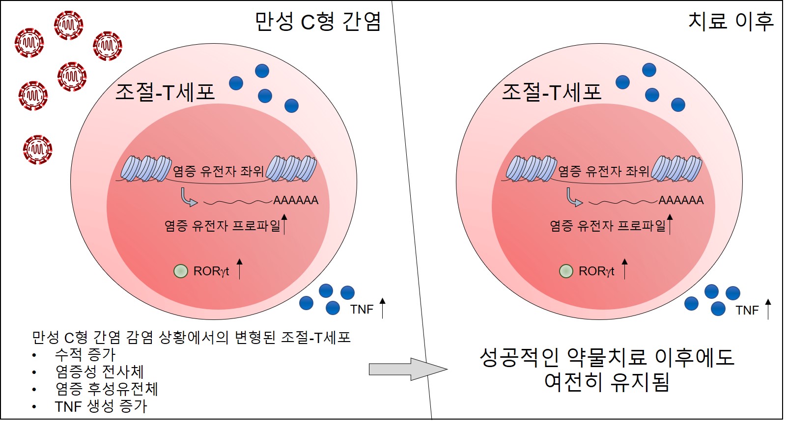 [그림1] 만성 C형 간염 환자의 항바이러스제 약물치료 이후에도 조절 T세포에 염증성 흔적이 남는다는 연구 결과        만성 C형 간염 환자의 말초 혈액에서 조절 T세포의 수적 증가가 나타난다. 이러한 증가는 치료 이후에도 지속됨을 확인하였다. 조절 T세포는 만성 C형 간염 환자의 전사체와 후성유전체에서 정상인 대비 증가된 염증성 특성을 가지는 것으로 확인됐다. 이러한 변화는 치료 이후에도 유지됐다. 유전체적 변화로 인하여 만성 C형 간염 환자의 조절 T세포는 염증성 사이토카인인 TNF를 분비할 수 있게 된다.