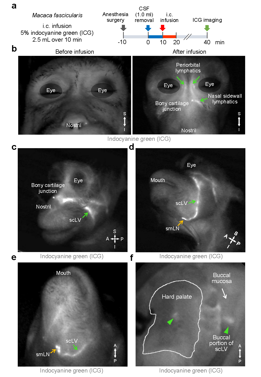 Figure 2. Brain fluid drains through facial and neck lymphatics in monkeys
Images show how cerebrospinal fluid (CSF), labeled with a fluorescent tracer, travels through lymphatic vessels around the eyes, nasal area, hard palate, and neck following infusion into the brain.