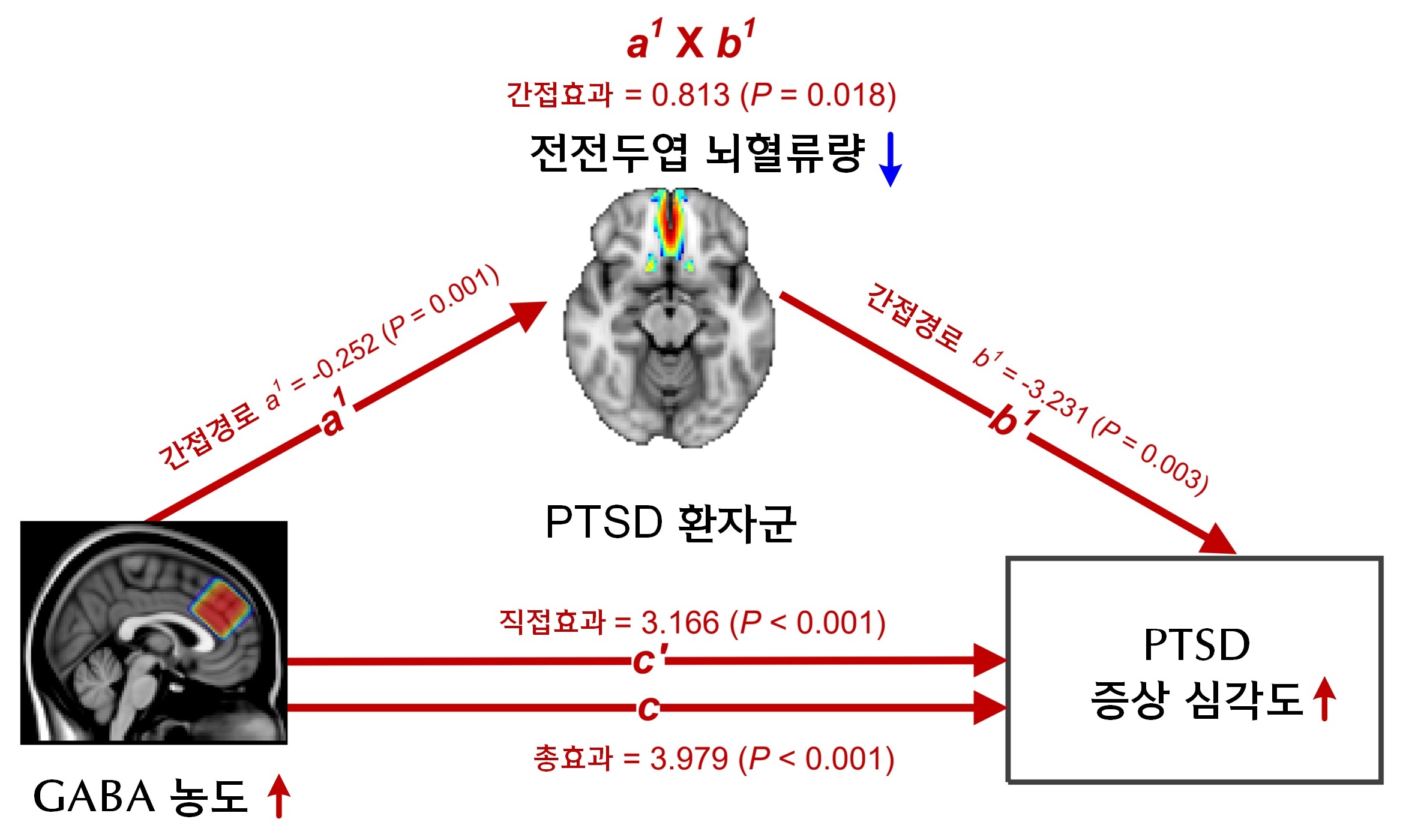 [그림3] 전전두엽 GABA 농도가 뇌혈류량을 통해 PTSD 증상 심각도에 미치는 영향 분석한 결과
