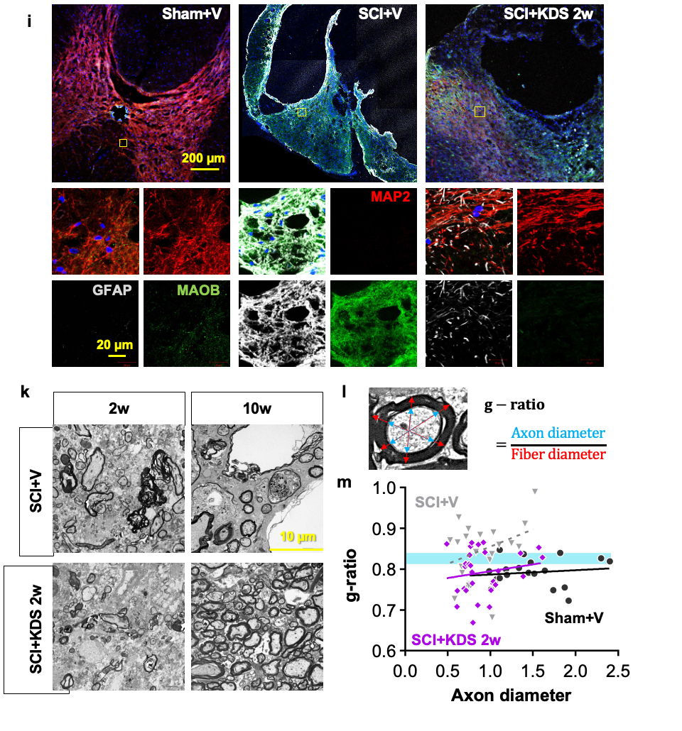 Figure 2. Neuroprotective and tissue-restorative effects of KDS2010 In the spinal cord injury animal model, administration of KDS2010 suppressed the injury-induced overexpression of MAOB in astrocytes and restored the expression of MAP2, a neuronal marker protein, thereby preserving neurons at the lesion site (a). Electron microscopy further revealed that demyelinated and disrupted axons were restored to near-normal myelinated structures (b–c). Quantitative g-ratio analysis confirmed that the abnormally thinned myelin was significantly thickened following treatment (d).