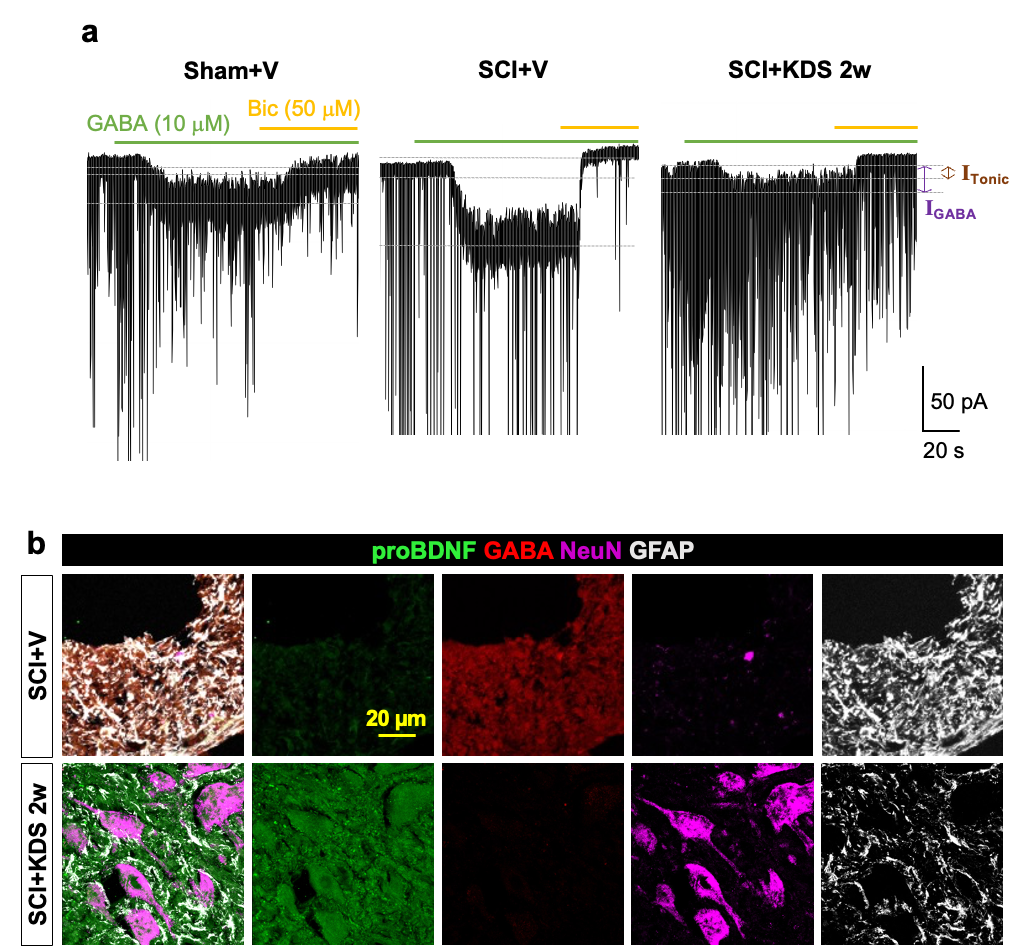 Figure 3. Functional and molecular recovery effects of KDS2010 Electrophysiological analyses showed that spinal cord injury led to an excessive increase in tonic GABA currents (persistent inhibitory signaling), which were restored to normal levels after KDS2010 administration, thereby re-establishing excitatory–inhibitory balance between neurons (a). At the molecular level, KDS2010 reduced aberrant GABA production from astrocytes while simultaneously increasing the expression of proBDNF (a precursor of brain-derived neurotrophic factor), thereby shifting the injured spinal cord environment toward a state favorable for neural regeneration (b).