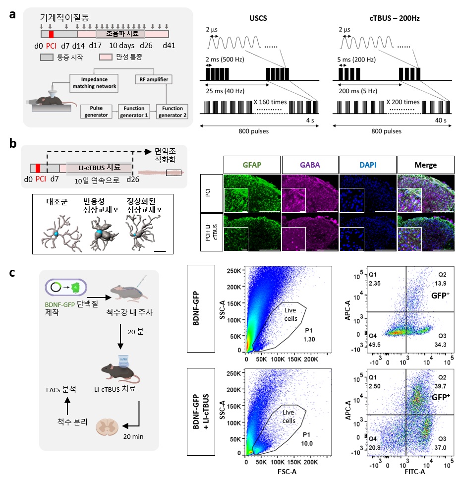 [그림2] 과활성화된 척수 세포를 진정시키고 통증 유발 물질을 제거하는 뇌파 패턴 초음파