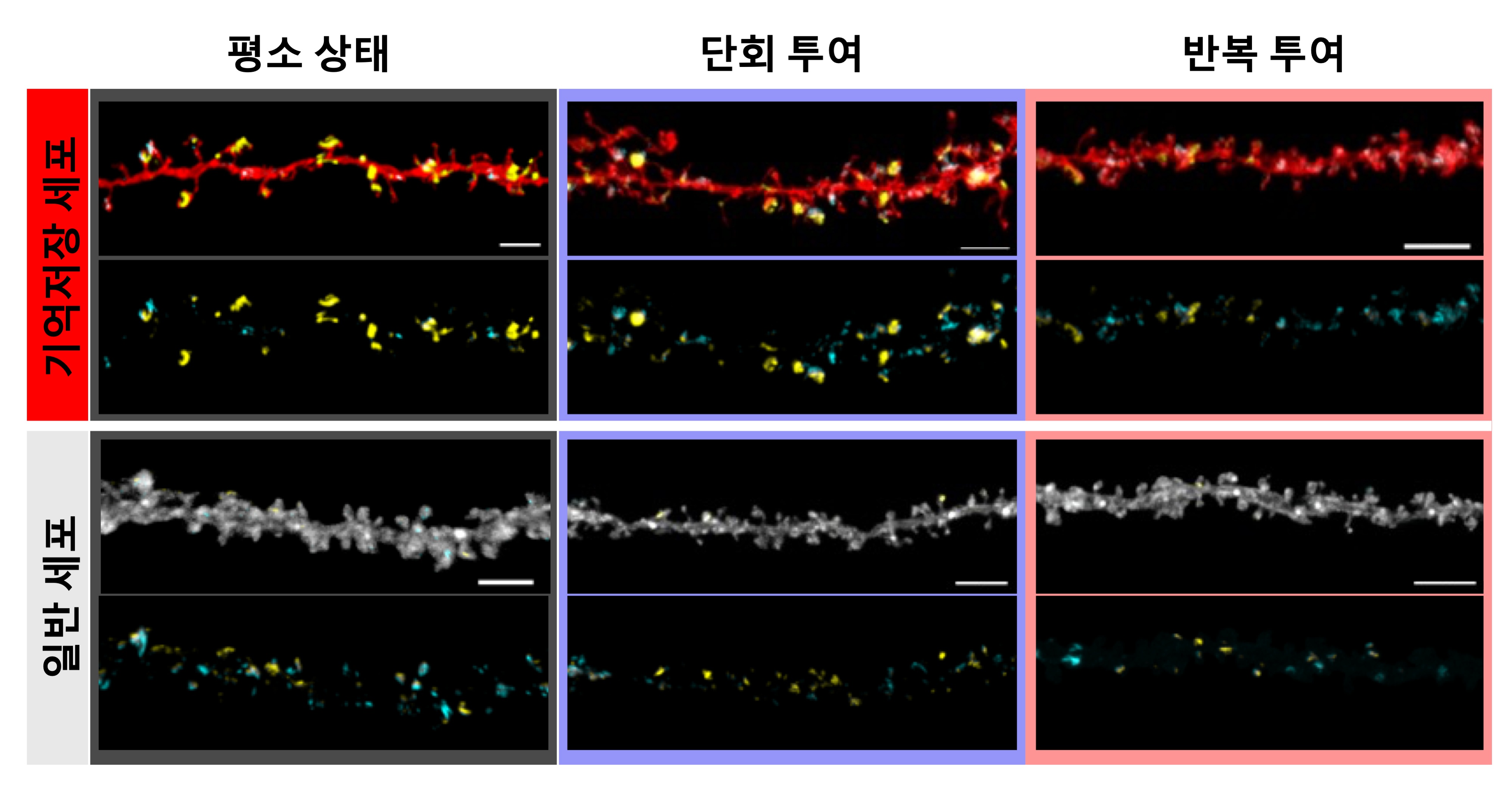 [그림2] 학습 이후 단백질 억제제 투여 방식에 따른 시냅스 변화 사진