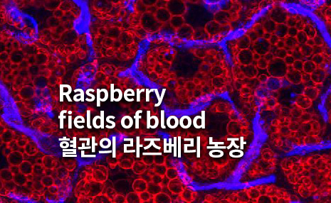The 3rd Art in Science_혈관의 라즈베리 농장(Raspberry fields of blood)