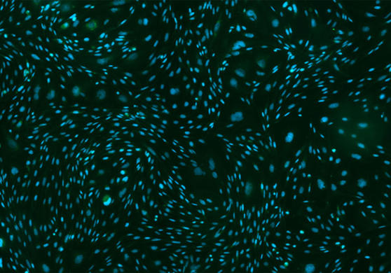 푸른빛과 초록빛이 함께 헤엄치며 역동적으로 소용돌이치는 모습을 보면 무엇이 생각나는가. 빈센트 반 고흐가 바라본 밤하늘의 별들이 마치 이런 모습이었을까? 그의 명작 ‘별이 빛나는 밤’에는 밤하늘의 별들이 물수제비처럼 소용돌이치는 모습을 묘사하고 있다. 이 작품은 약물에 대한 반응 및 독성연구에 많이 이용되는 세포 스크리닝 실험 과정 중 포착한 것이다. CHO세포(차이니즈 햄스터 난소 암세포)에 ‘DAPI(푸른빛 형광)’와 ‘GFP(초록빛 형광)’을 발하게 한 후, 이 둘의 공존을 공초점 현미경으로 촬영하였다. ‘고요한 격정’이라는 말처럼, 검은 바탕 위에서 형광을 발하는 세포들의 모습은 칠흑같이 어두운 밤하늘 속 밝게 빛나는 별처럼 생동감 넘치고 아름답다. ‘별이 빛나는 밤’을 그리던 시절, “별을 보는 것은 항상 나 자신을 꿈꾸게 한다”라고 했던 빈센트 반 고흐. 형광으로 빛나는 세포를 연구하며, 뇌질환 치료 약물을 개발하여 인류에 도움이 되고자 하는 꿈을 다시 한번 되새긴다.