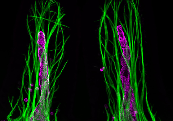 소장 융모 내에는 길쭉하게 뻗은 관모양의 형태로 내피세포로 구성되어 있는 암죽관이라는 림프관이 존재한다. 암죽관은 장내로 들어온 영양분 중 지방산과 지용성 비타민 등 지용성 영양분을 흡수하는데 중요한 역할을 한다. 우리 연구단은 소장 융모 내에 암죽관 형태 및 기능을 규명하였고, 연구해오고 있다. 소장 융모 하나의 작은 구조 안에 그보다도 미세한 암죽관의 형태와 기능을 찾아내기 위해서는 다양한 실험 기술을 통한 더 깊은 자세한 관찰이 필요했다. 이를 통하여 눈에 보이지 않는 융모 내 암죽관의 구조 및 기능을 밝혀내었고, 암죽관의 중요성을 알게 된 것이다. 위 사진은 암죽관과 암죽관 주변세포들의 상호작용을 연구하는 과정에서 촬영한 사진으로 암죽관(보라색)과 주변 평활근 세포(녹색)를 촬영한 것이다. 암죽관을 발견하고 연구하는 과정이 나태주 시인의 ‘풀꽃’이라는 시를 떠올리게 한다. ‘자세히 보아야 예쁘다, 오래 보아야 사랑스럽다, 너도 그렇다.’  의미뿐만 아니라 사진도 풀들 속에 가려서 잘 보이지 않는 꽃을 연상하게 한다.