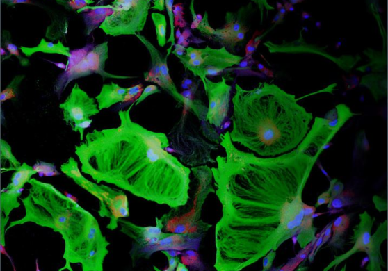 전쟁과 식민주의의 역사를 지닌 베트남에서 태어나 자란 저자는 신체적, 정신적 고통을 겪는 군인들의 상처를 가까이서 목격해왔다. 20세기 초 고통의 게이트 통제 이론이 제안되었으며 이에 따라 신경 기전이 중추 신경계 내 신경섬유 흐름에 끼치는 영향과 치료법 개발이 점진적으로 이뤄지고 있다. 해당 이미지는 척추 별세포가 스트레스로 인해 원래의 모양에서 비대하게 변한 걸 공초점 현미경으로 촬영한 것이다. 마치 나라를 지키기 위해 희생한 군인들처럼 고통이 꽃으로 승화되는 모습이 연상된다.