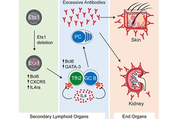 How a Single Faulty Gene Can Lead to Lupus