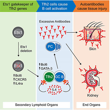 How a Single Faulty Gene Can Lead to Lupus
