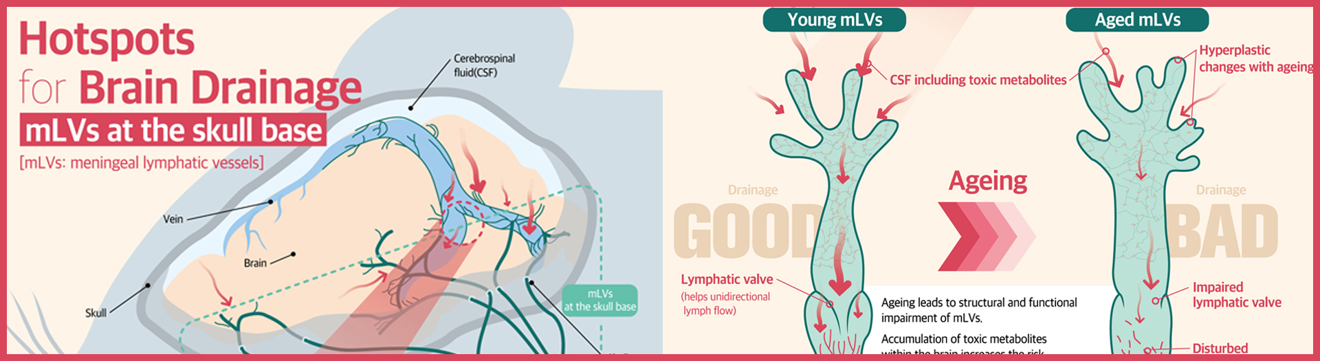 Newly identified meningeal lymphatic vessels answers the key questions about brain clearance
