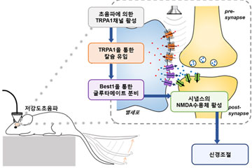 수술 없이 초음파만으로 뇌질환 치료 길 열렸다
