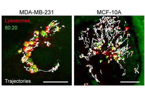 Selective killing of cancer cells by cluttering their waste disposal system