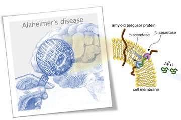 New method to monitor Alzheimer’s proteins