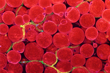 Blood vessels can make you fat, and yet fit: Healthy obesity begins where metabolic disorders emerge
